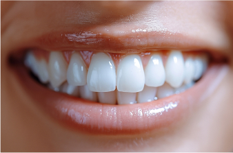 After — smile makeover at D'Arcy Dental Okotoks