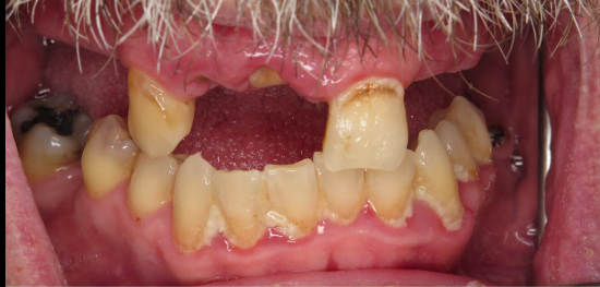 Before — teeth whitening at D'Arcy Dental Okotoks